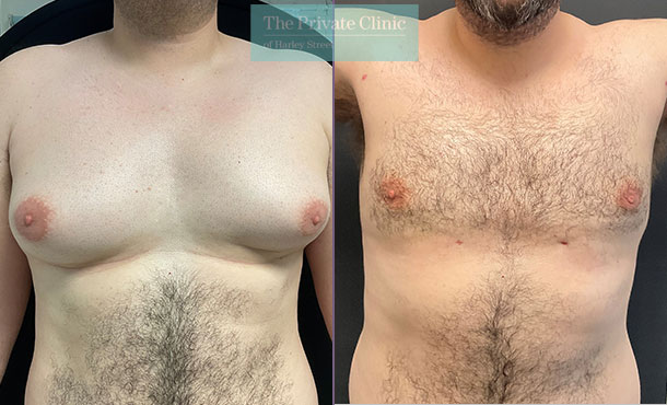 creed cox like huge puffy nippels photo deb deveau recommends huge puffy nippels pic