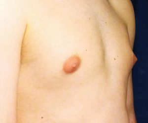 ashraf foud add photo pink puffy nipple