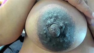 huge dark areolas