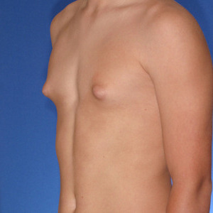 huge puffy nippels foot smother huge puffy nippels