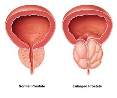 donna sexton smith recommends Milk Prostate Video