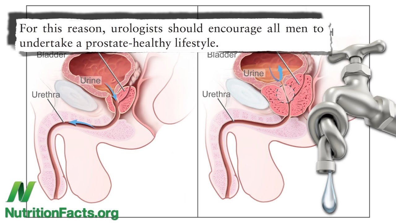 aaron stanley recommends milk prostate video pic